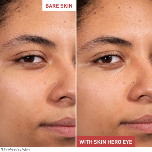view 9/9 of Skin Hero Eye, , large